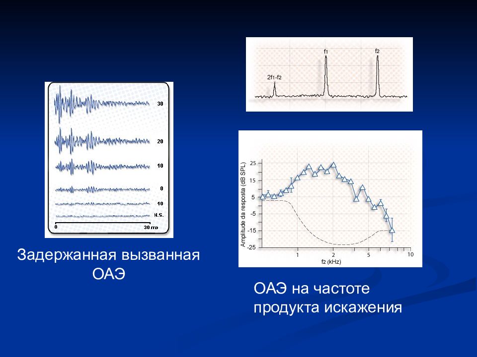 Методы исследования слухового анализатора презентация