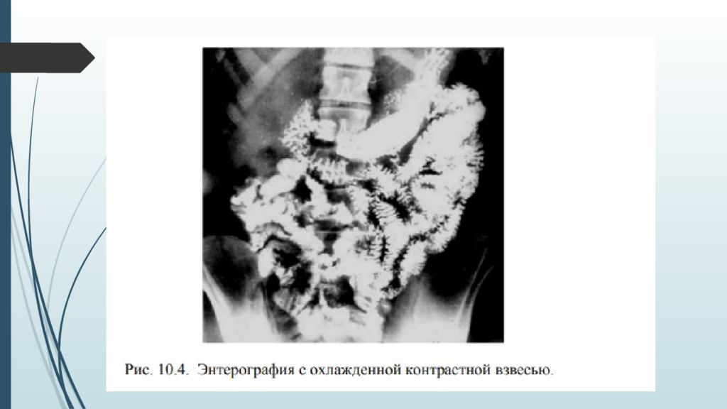 Рентгенография желудка презентация