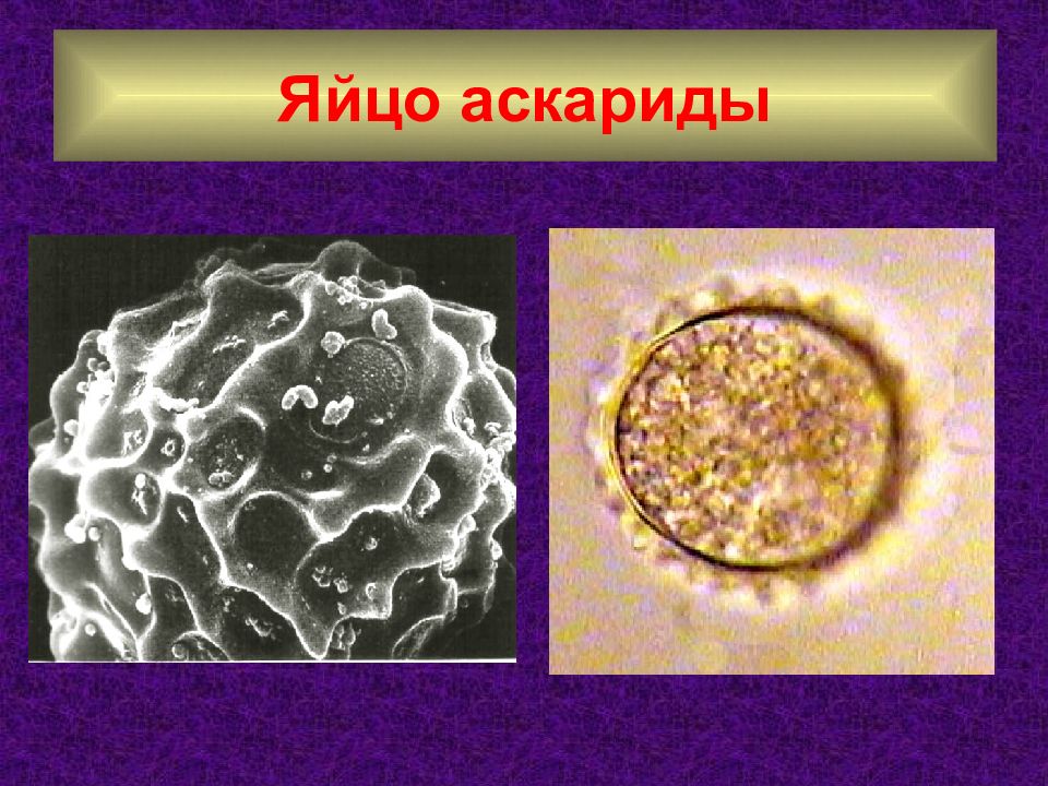 Яйцо аскариды рисунок