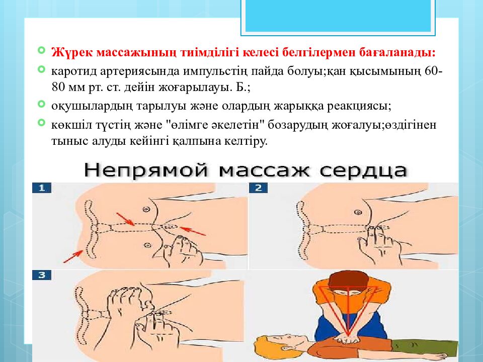 Тақырыбы:Жүрек-өкпе реанимациясы.Мәйітпен жұмыс жасау ережелері