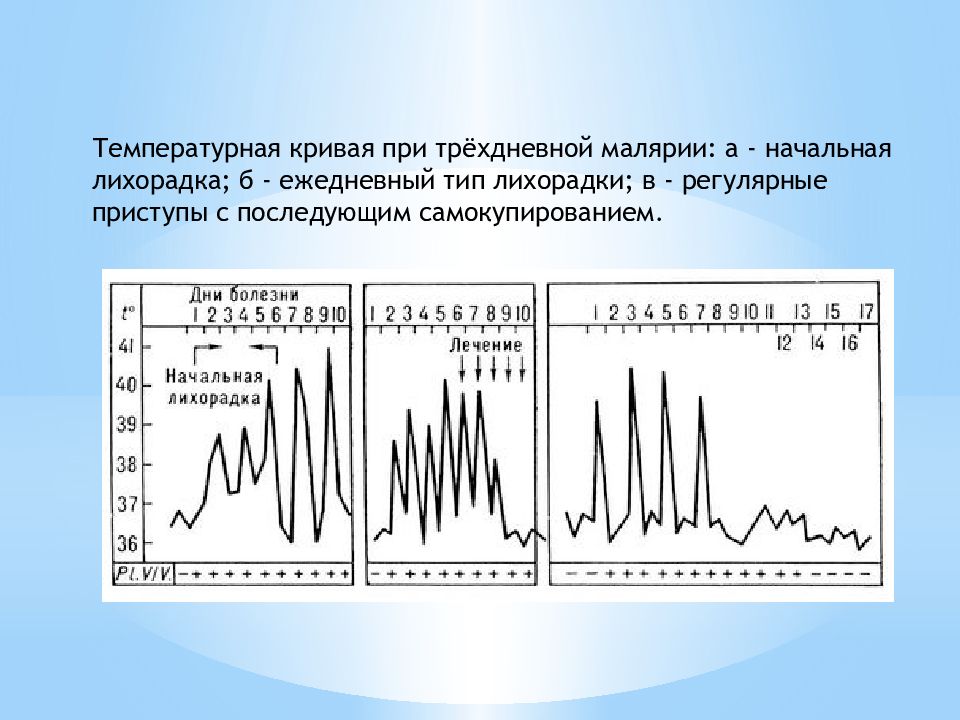 Характерная температура. Температурная кривая при малярии 3 дневной. Типы температурных кривых при малярии. Температурная кривая при четырехдневной малярии. Температура кривая при малярии.