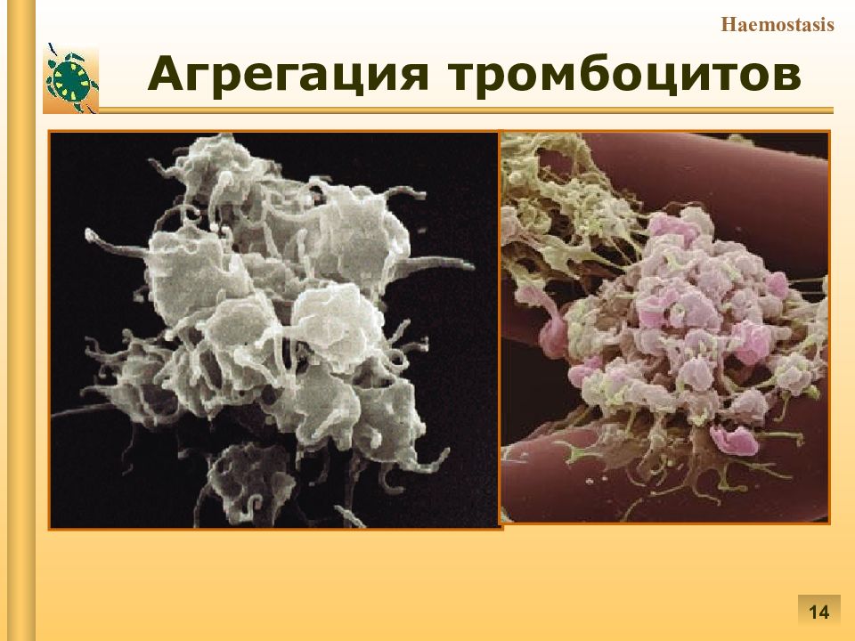 Патофизиология гемостаза презентация