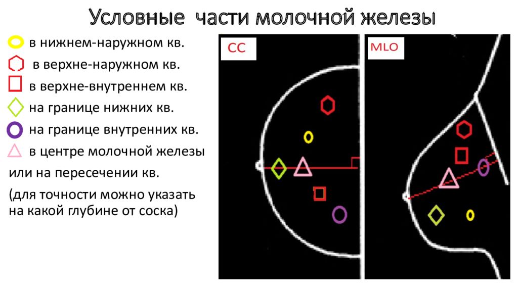 Наружном квадранте. Деление молочной железы на квадранты. В Верхне наружном квадранте молочной железы.