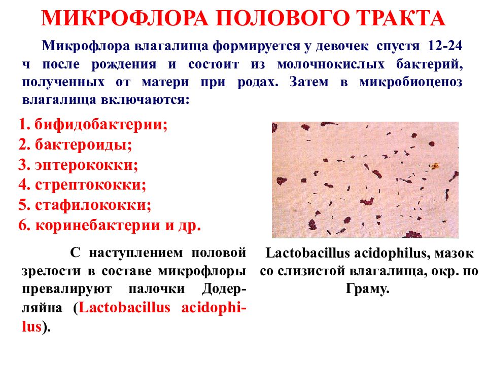 Презентация на тему молочница