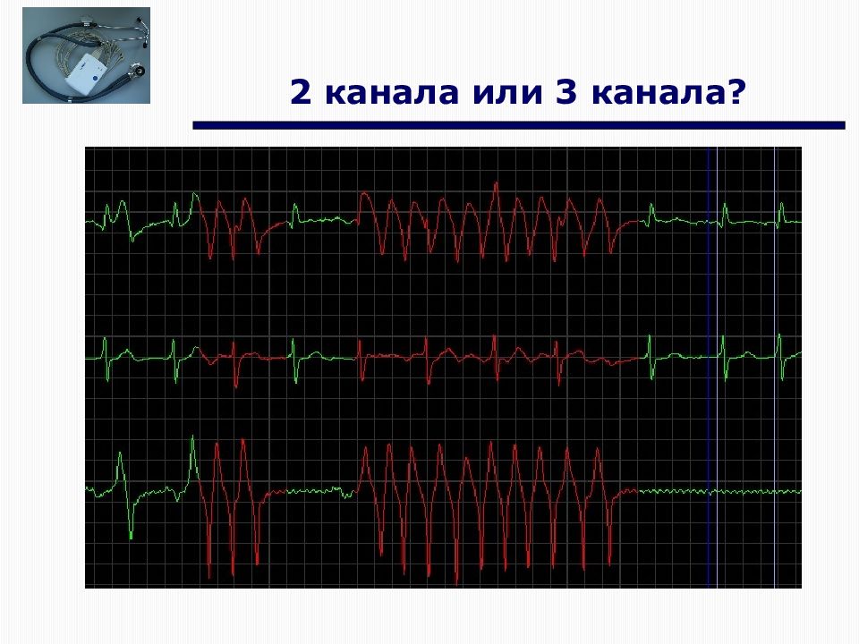 Современное экг. Физические основы ЭКГ. Физические основы электрокардиографии. Электрическая активность сердца.