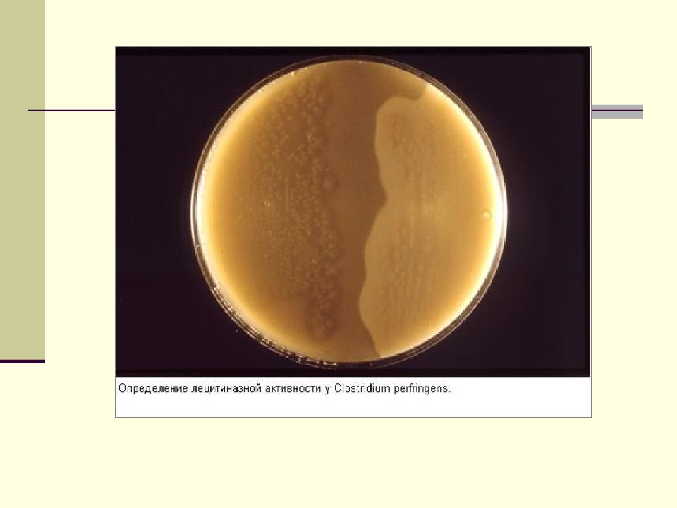 лецитиназная активность стафилококков. желточно солевой агар микробиология. стафилококк на жса. жса лецитиназная активность. лецитиназная активность стафилококков.