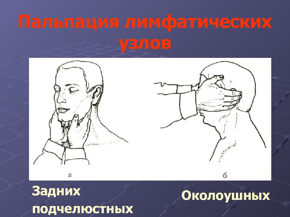 Осмотр пальпация. Околоушные лимфоузлы пальпация. Пальпация регионарных лимфоузлов. Пальпация периферических лимфоузлов алгоритм. Пальпация регионарных лимфатических узлов.