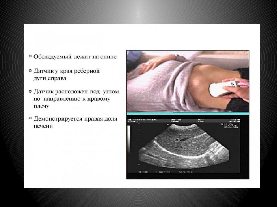 Подготовка к узи обп. УЗИ брюшной полости печень. Подготовка к УЗИ печени. Подготовка пациента к УЗИ желчного пузыря. УЗИ брюшной полости и печени подготовка.