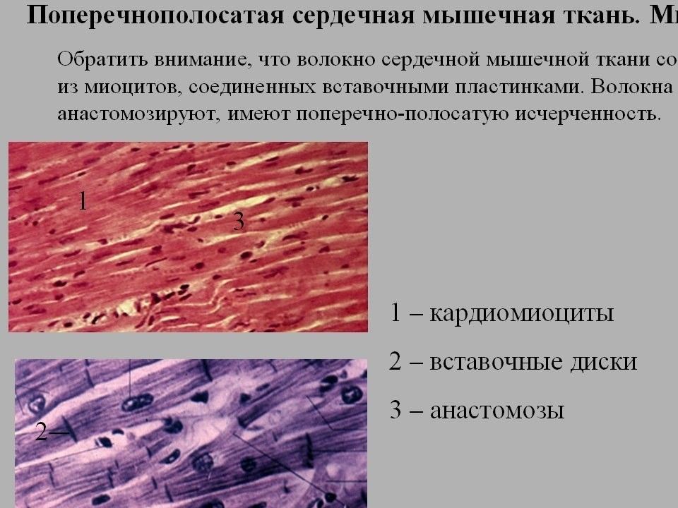 Какими буквами обозначены изображения сердечной поперечнополосатой мышечной ткани