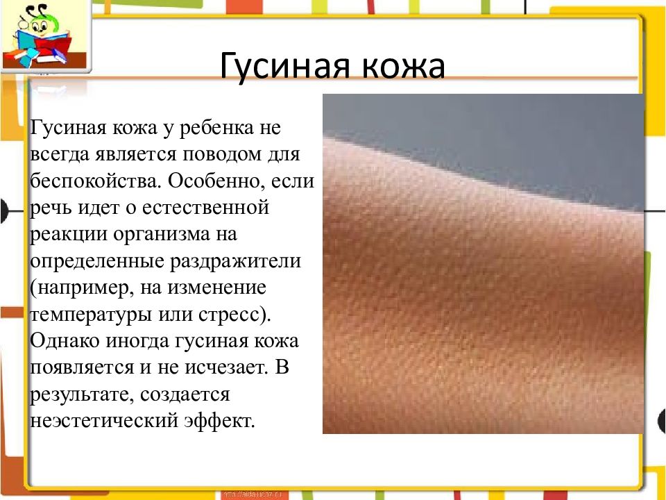 Что значит теле. Гусиная кожа на коже у ребенка. Появление гусиной кожи. Гусиная кожа у грудничка.