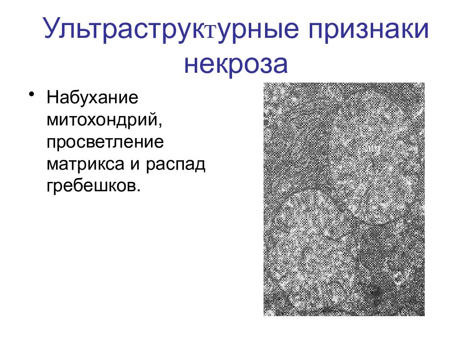 Признаки некроза. Набухание митохондрий. Ультраструктурные изменения при некрозе клеток. Ультраструктурные признаки некроза.