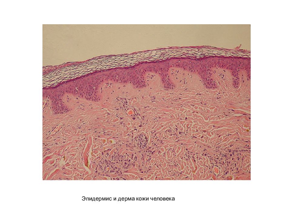 Рассмотрите рисунок 90 найдите эпидермис дерма и гиподерма