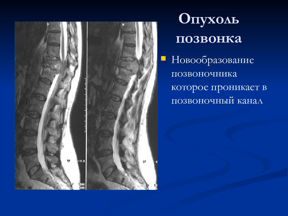 Лучевая диагностика позвоночник презентация