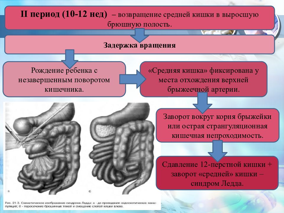 Трансплантация кишечника презентация