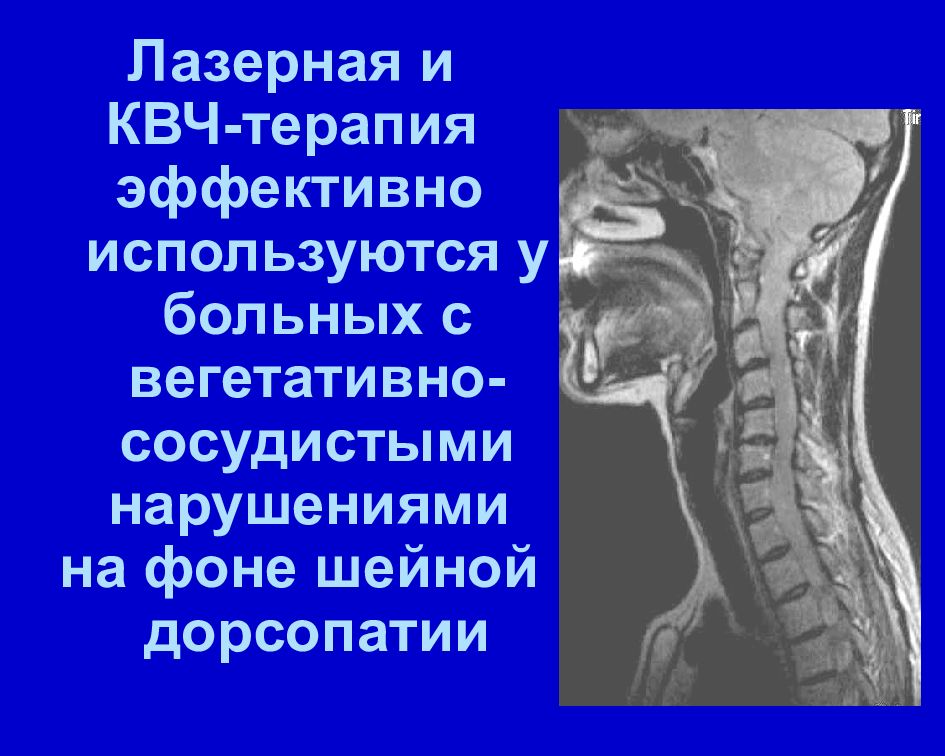 Шейная дорсопатия. Дорсопатии реабилитация. Реабилитация при дорсопатии.