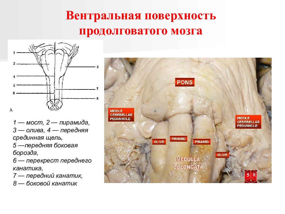 Дорсальная поверхность мозга. Вентральная часть ствола головного мозга. Дорсальная поверхность ствола головного мозга. Вентральная поверхность стволовой части головного мозга. Структуры дорсальной поверхности продолговатого мозга.