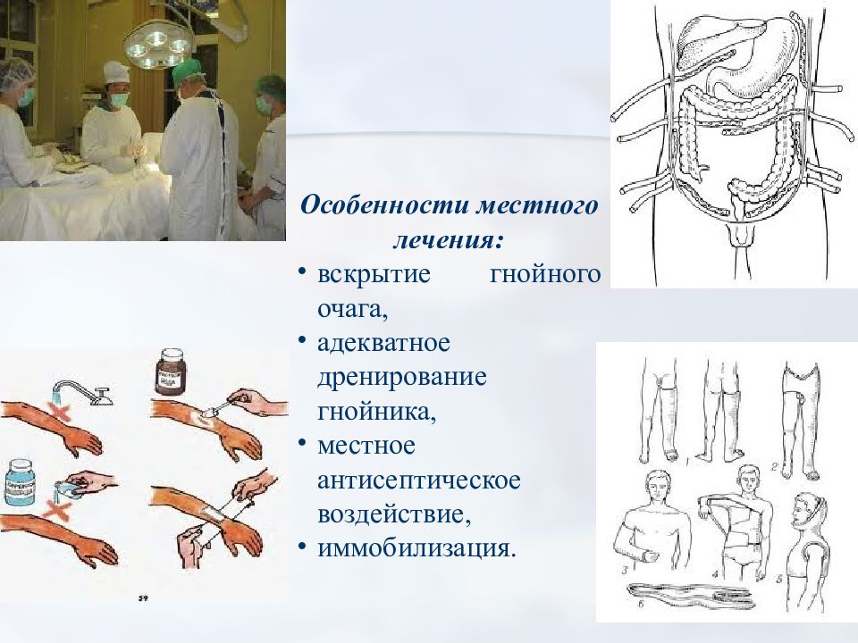 Презентация по хирургии сепсис