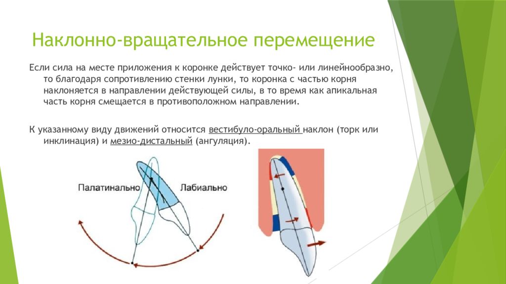 Виды перемещения. Наклонно вращательное перемещение зуба. Наклонно-вращательное движение зуба. Корпусное перемещение зуба. Типы ортодонтического перемещения зубов.