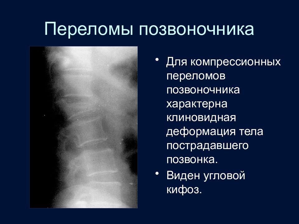 Лучевая диагностика позвоночник презентация