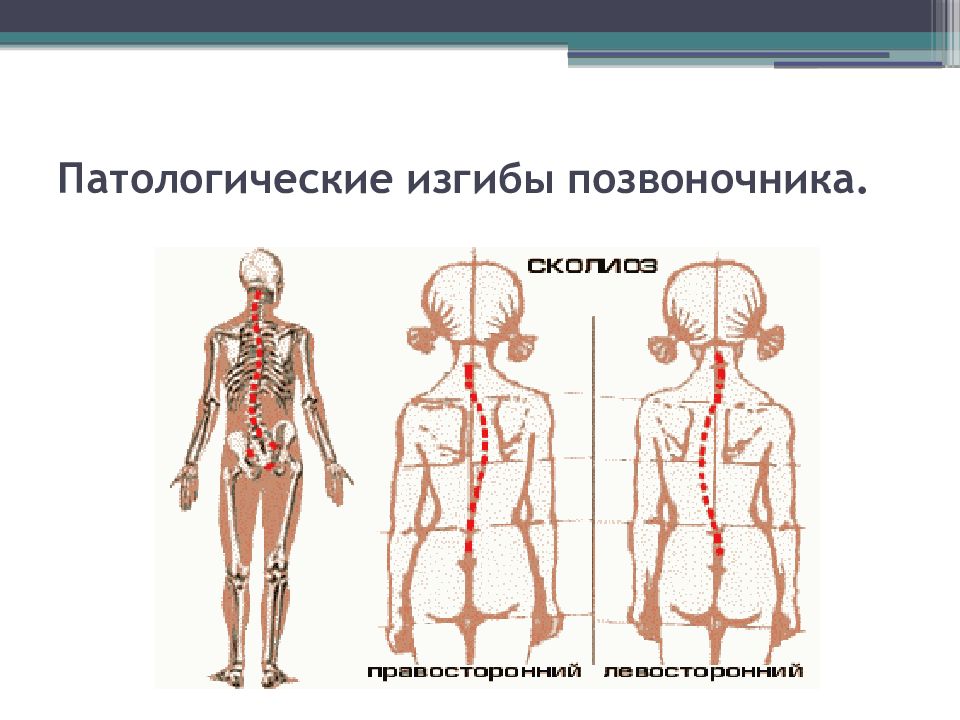 Гигиена опорно двигательного аппарата презентация