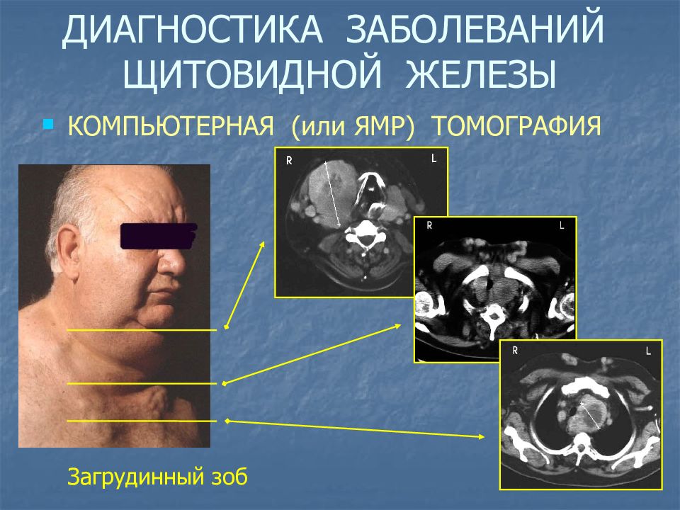 Диагностика заболеваний щитовидной железы презентация