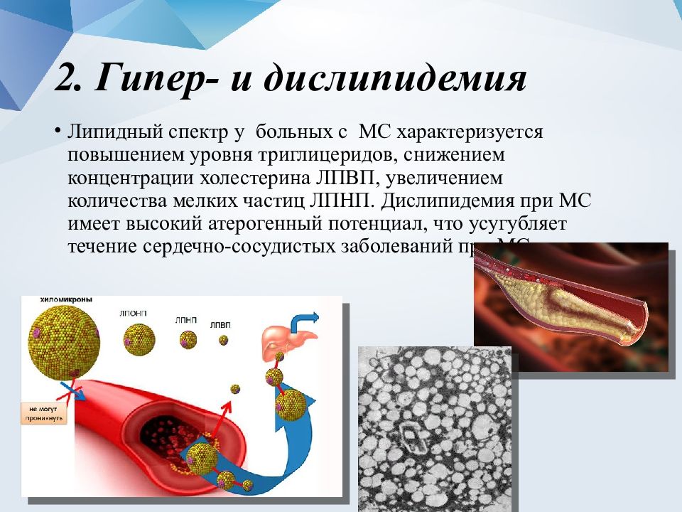 Дислипидемия что это такое. Дислипидемия 2а. Дислипидемия 2 b. Гипер и дислипидемия. Синдром дислипидемия.