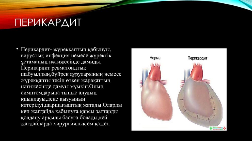 Эндокардит миокардит перикардит презентация