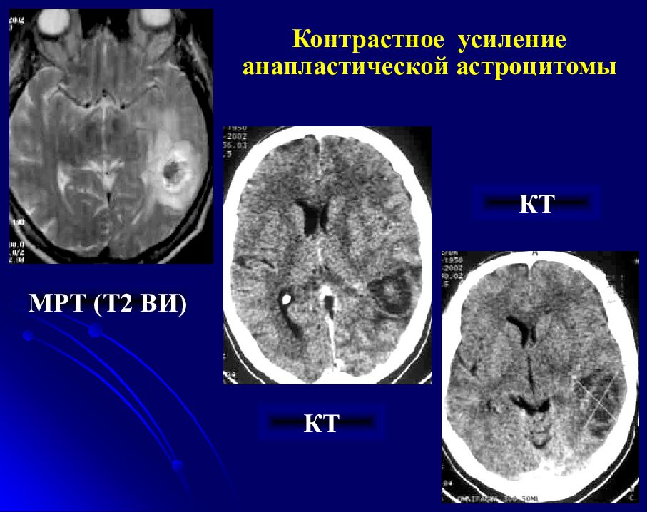 Гиперденсные структуры на кт изображениях