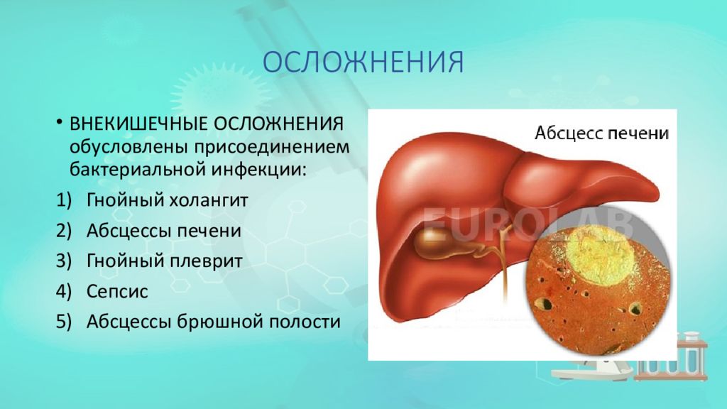 Последствия печени. Аскаридный абсцесс печени это. Внекишечные осложнения. Абсцесс печени осложнения.