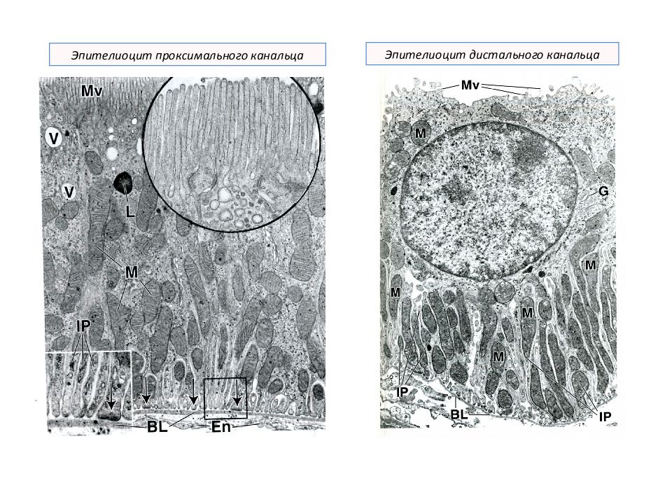 Эпителиоциты. Эпителиоцит проксимального канальца. Эпителиоцит дистального каеальца. Проксимальный каналец гистология. Дистальный и проксимальный каналец гистология.