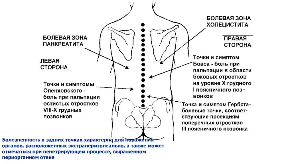 Симптомы поражения органов. Болевая зона Боаса. Болевые точки ЖКТ. Болезненные зоны при панкреатите. Болевые точки и зоны при поражении желчного пузыря.