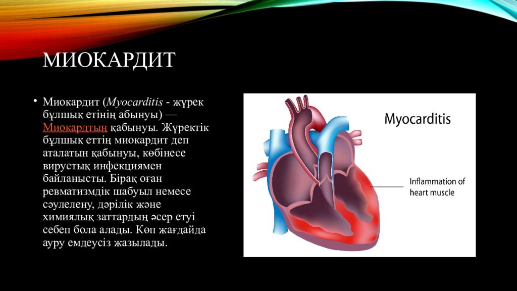 Миокардит картинки для презентации