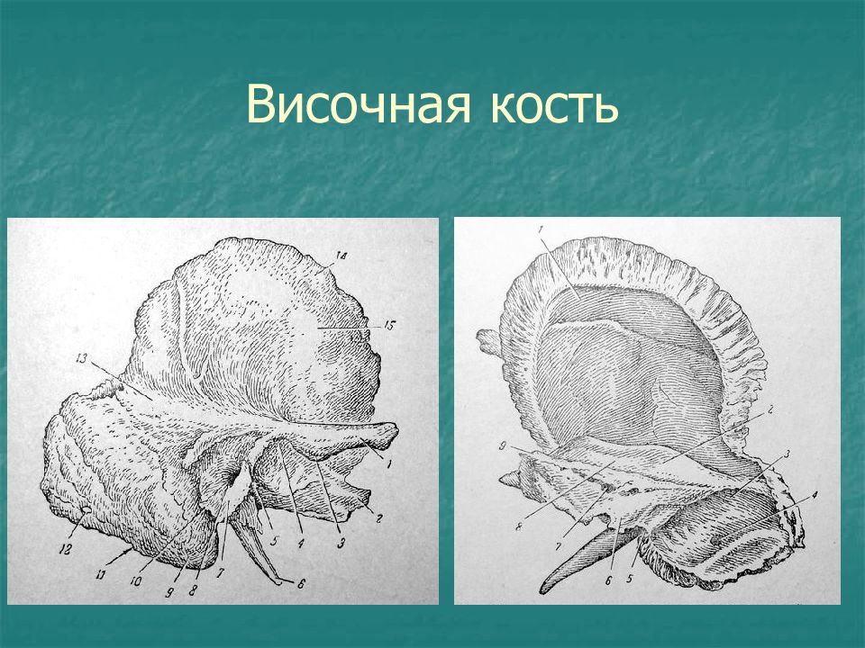 Кт височной кости москва. Кт височной кости. Височная кость на кт. Височная кость презентация. Чешуя височной кости кт.