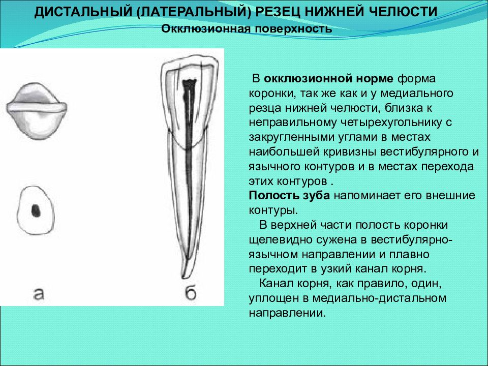 Полость поверхность. Латеральный резец верхней челюсти анатомия. Нижний медиальный резец анатомия. Латеральный резец нижней челюсти анатомия. Нижний медиальный резец полость зуба.