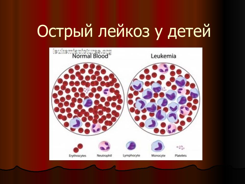 Лейкоз картинки для презентации