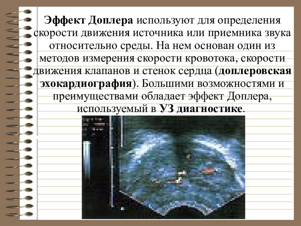 Измерение скорости кровотока. Эффект Доплера применение. Эффект Доплера измерение скорости. Доплеровский метод измерения скорости.