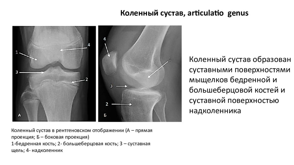 Сустав норма. Рентген суставной щели коленного сустава. Анатомия надколенника на рентгене. Суставная щель голеностопного сустава норма. Суставная щель коленного сустава проекция.