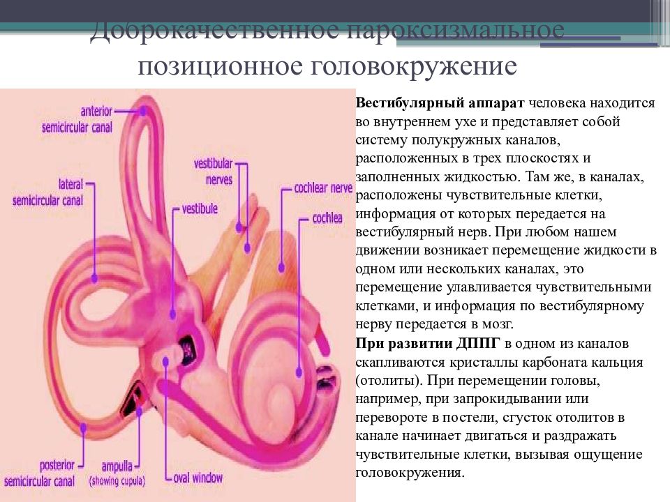Почему закладывает уши и кружится голова. Доброкачественное позиционное головокружение. Доброкачественное пароксизмальное позиционное головокружение. Отолиты в ушах. Отолиты во внутреннем ухе.