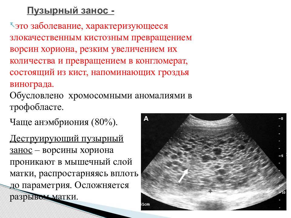 Патология плаценты презентация