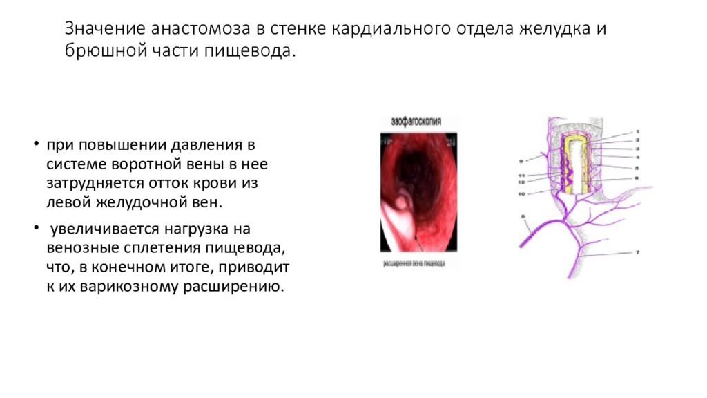 Анастомозы передней брюшной стенки. Анастомоз в стенке пищевода. Анастомоз между пищеводом и желудком. Венозный анастомоз пищевода.