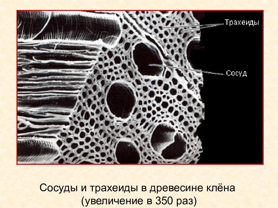 Сосуды флоэмы. И трахеиды древесины (Ксилема).. Ксилема микроскоп. Флоэма сосуды и трахеиды. Проводящая ткань растений трахеиды.