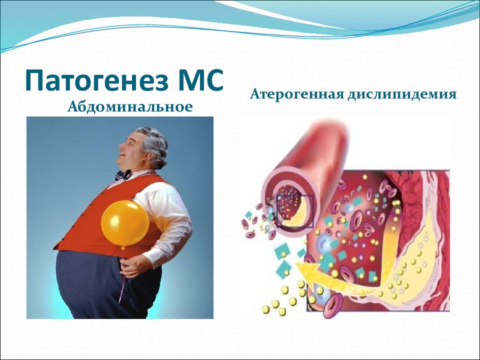 Дислипидемия ожирение. Синдром дислипидемия. Дислипидемия презентация. Метаболический синдром инсулинорезистентности. Инсулинорезистентность и гиперинсулинемия.