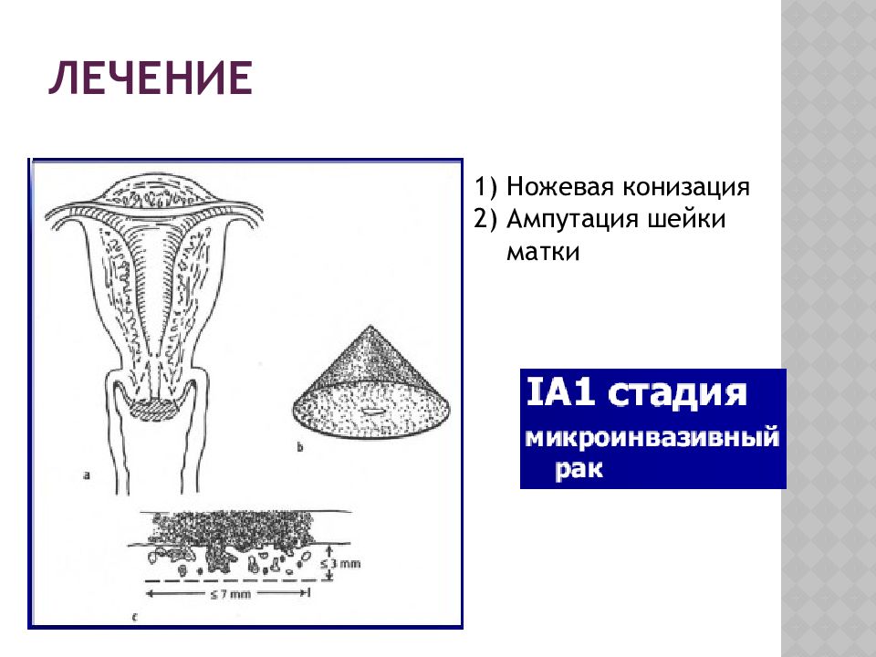 Диаграмма знаки варзара относится к