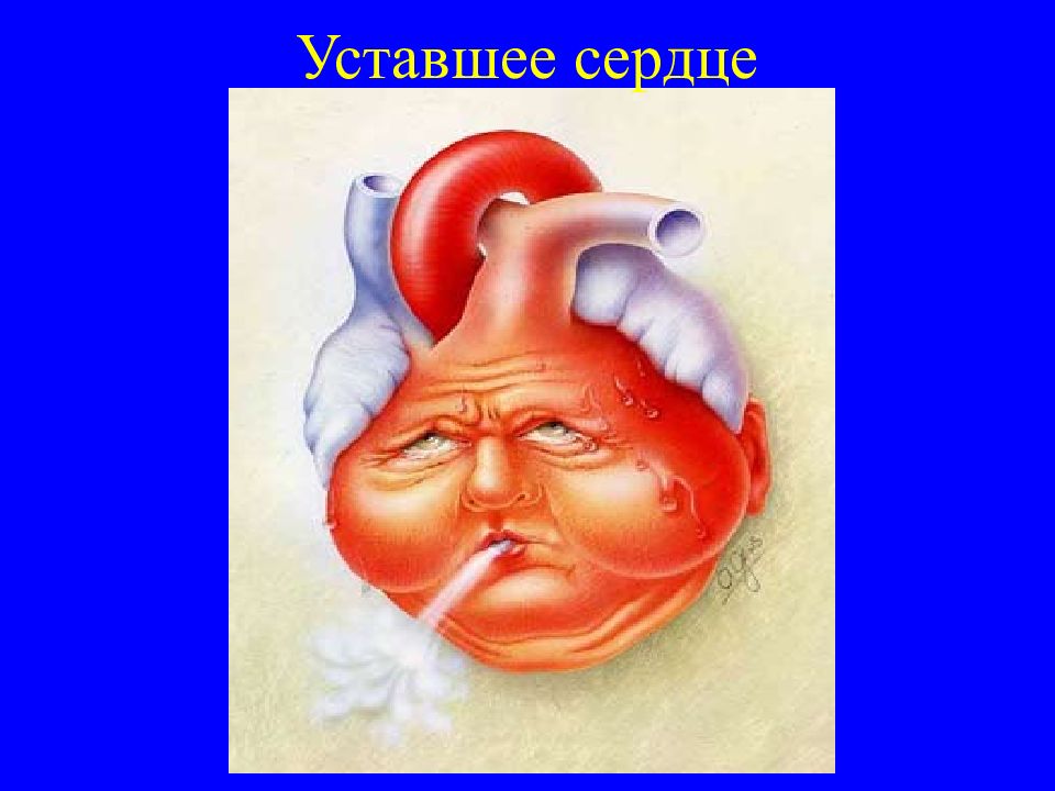 Утомляемость сердца. Острая сердечная недостаточность картинки. Сосудистая недостаточность картинки. Сердечная недостаточность изображение.