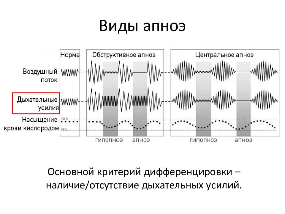 Что такое апноэ. Первичное и вторичное апноэ.