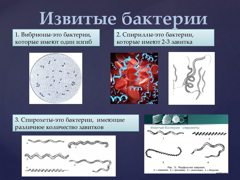 Примеры бактерий. Спириллы и спирохеты. Бактерии спириллы вибрионы бациллы спирохеты. Извитые бактерии вибрионы спириллы спирохеты. Спиралевидные спириллы бактерии.