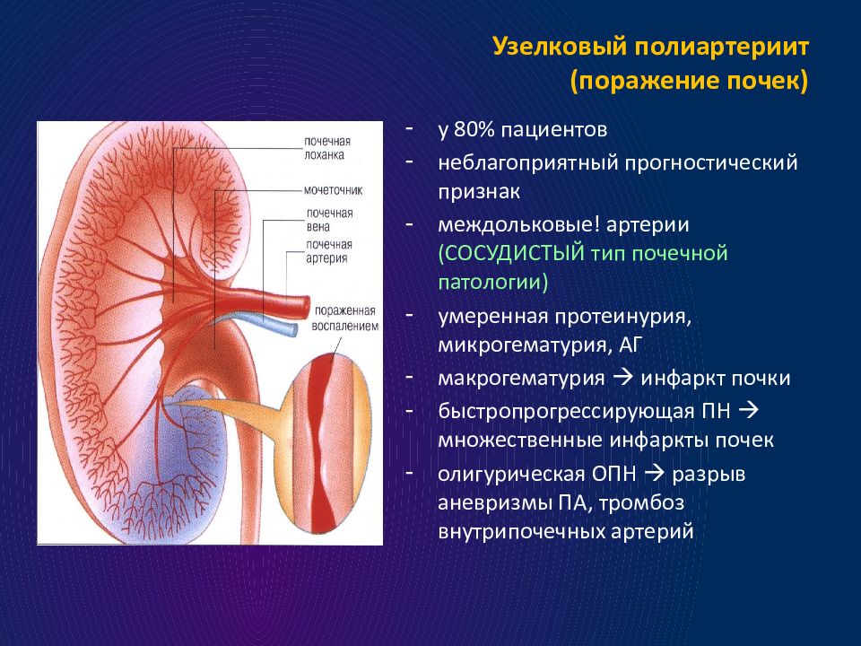 Узелковый полиартериит презентация