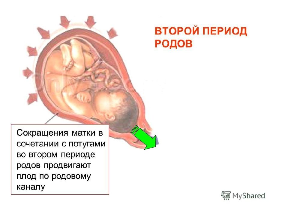 Периоды родов картинки