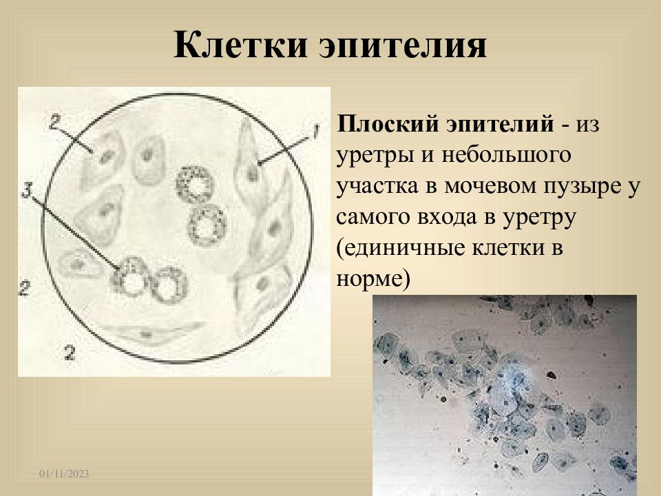 Клетки плоского эпителия что это