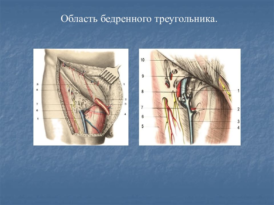 Бедренный канал. Бедренный треугольник топографическая анатомия. Треугольник Скарпа бедренный канал. Бедренный скарповский треугольник. Треугольник Скарпа топографическая анатомия.